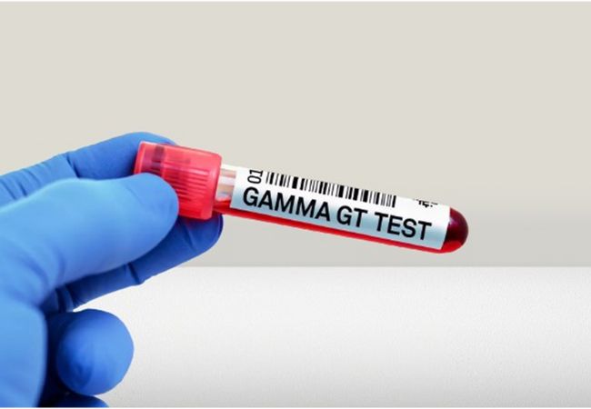 Quel est le taux alarmant de gamma GT ?