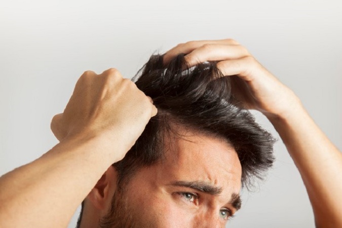 Tout savoir sur la greffe de cheveux