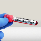 Quel est le taux alarmant de gamma GT ?